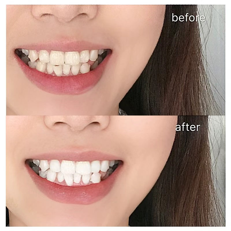 Disposable Teeth Whitening Strips