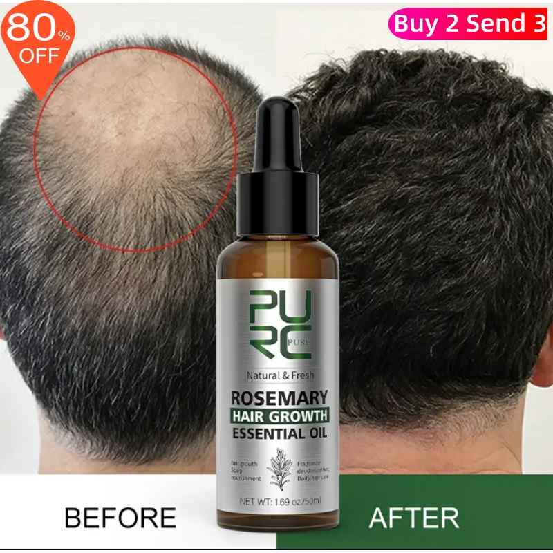 Rosemary & Ginger Hair Care Oil, 50 ml